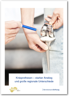 Cover Knieprothesen – starker Anstieg und große regionale Unterschiede