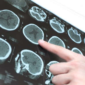 Arzt hält Befund des Patienten in Händen.